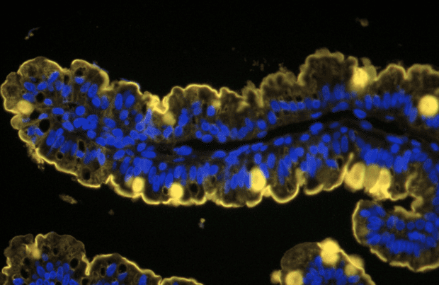 31 (1) Cells