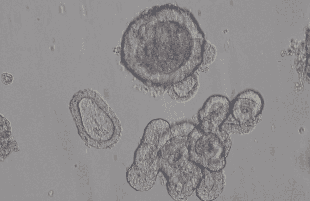 Captura (1) (1) Cells