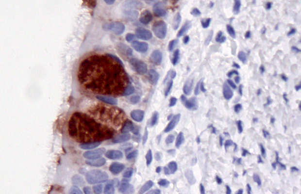 Captura (2) Cells